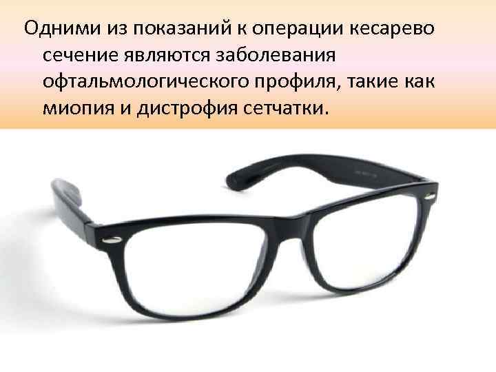 Одними из показаний к операции кесарево сечение являются заболевания офтальмологического профиля, такие как миопия