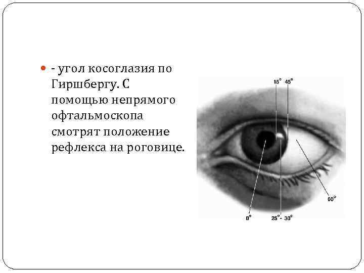  - угол косоглазия по Гиршбергу. С помощью непрямого офтальмоскопа смотрят положение рефлекса на