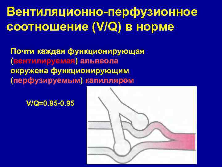 Вентиляционно-перфузионное соотношение (V/Q) в норме Почти каждая функционирующая (вентилируемая) альвеола окружена функционирующим (перфузируемым) капилляром