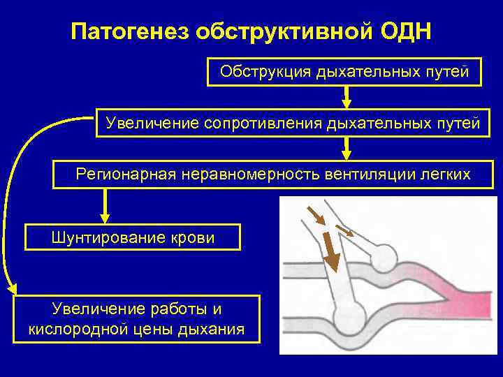 Виды обструкции дыхательных путей. Обструкция верхних дыхательных путей патогенез. Механизмы формирования дыхательной недостаточности. Дыхательная недостаточность вентиляционного типа. Виды обтурации дыхательных путей.