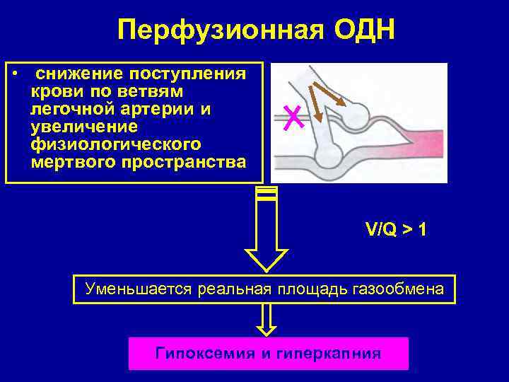 Перфузионная ОДН • снижение поступления крови по ветвям легочной артерии и увеличение физиологического мертвого