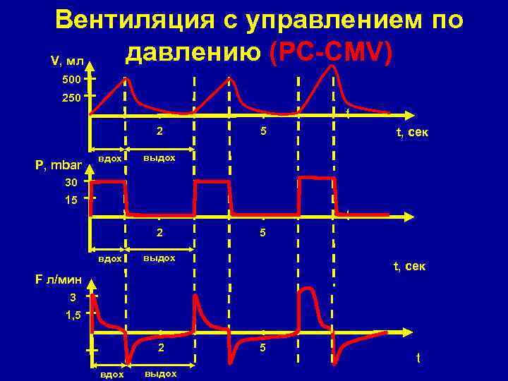 Вентиляция с управлением по давлению (PC-CMV) V, мл 500 250 t 2 P, mbar