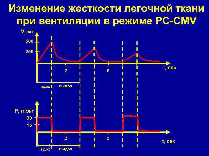 Изменение жесткости легочной ткани при вентиляции в режиме РC-CMV V, мл 500 250 2