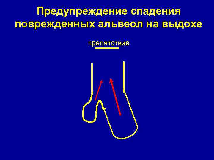 Предупреждение спадения поврежденных альвеол на выдохе препятствие 