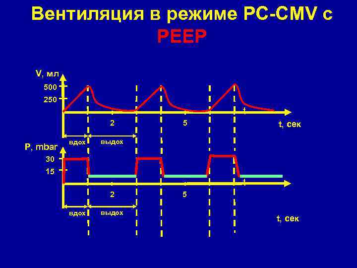 Вентиляция в режиме PC-CMV с РЕЕР V, мл 500 250 t 2 P, mbar