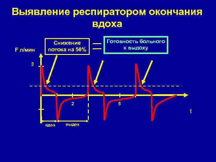 Выявление респиратором окончания вдоха F л/мин Снижение потока на 50% Готовность больного к выдоху
