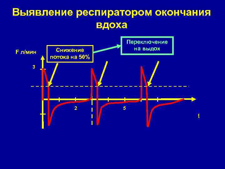 Выявление респиратором окончания вдоха F л/мин Переключение на выдох Снижение потока на 50% 3