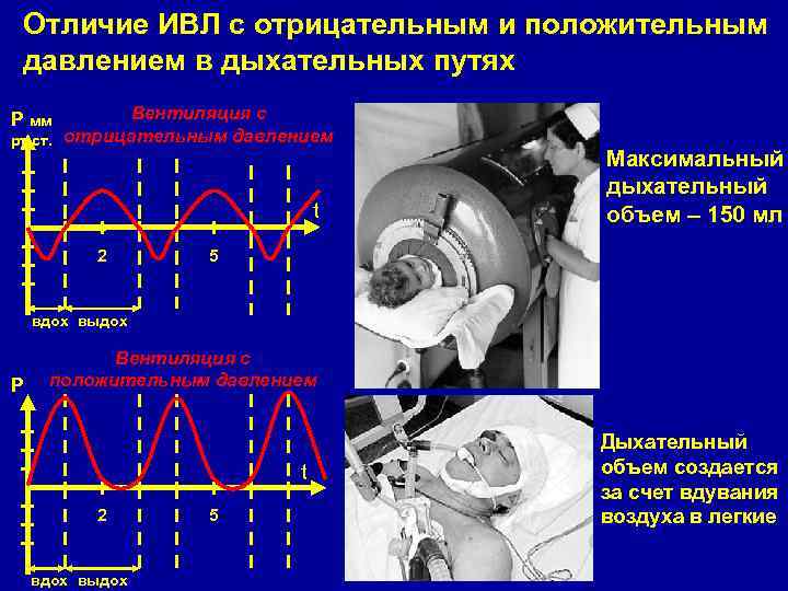 Ивл рекомендации. ИВЛ отрицательным давлением. Аппарат искусственной вентиляции легких с отрицательным давлением. Давление в дыхательных путях при ИВЛ. Пиковое давление в дыхательных путях норма.