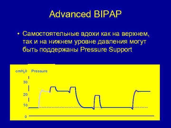 Advanced BIPAP • Самостоятельные вдохи как на верхнем, так и на нижнем уровне давления
