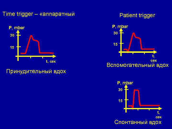 Time trigger – «аппаратный Patient trigger P, mbar 30 30 15 15 t, сек
