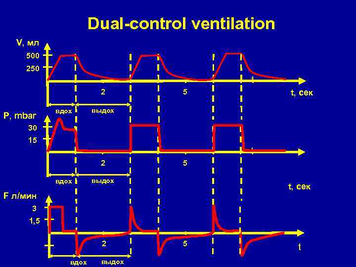 Dual-control ventilation V, мл 500 250 t 2 P, mbar вдох 5 t, сек