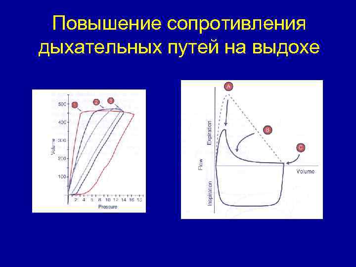 Повышение сопротивления дыхательных путей на выдохе 