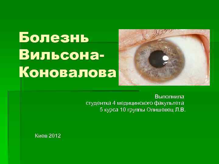 Болезнь Вильсона. Коновалова Выполнила студентка 4 медицинского факультета 5 курса 10 группы Олишевец Л.