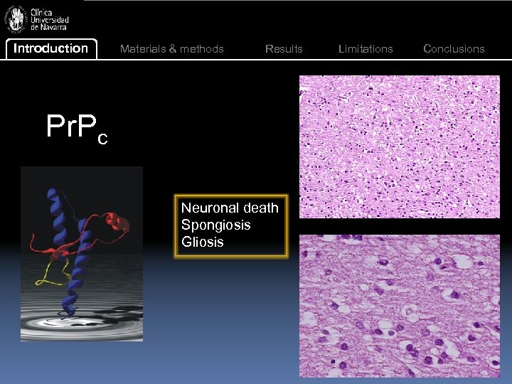Introduction Materials & methods Results Pr. Pc Neuronal death Spongiosis Gliosis Limitations Conclusions 