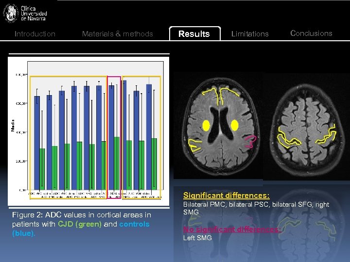 Introduction Materials & methods Results Limitations Conclusions Significant differences: Figure 2: ADC values in