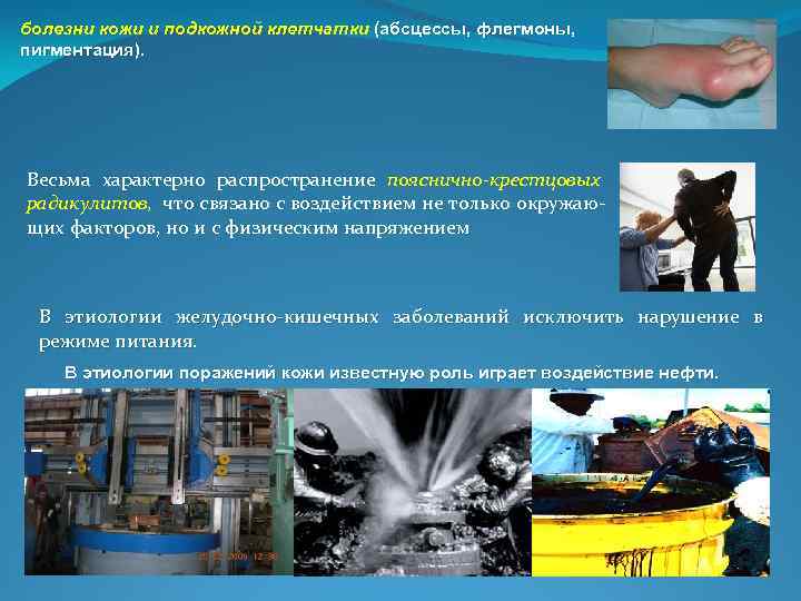 болезни кожи и подкожной клетчатки (абсцессы, флегмоны, пигментация). Весьма характерно распространение пояснично-крестцовых радикулитов, что