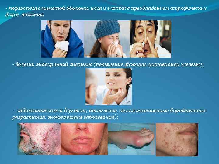  поражения слизистой оболочки носа и глотки с преобладанием атрофических форм, аносмия; - болезни