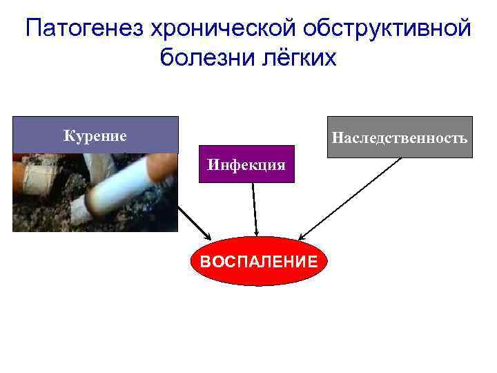 Патогенез хронической обструктивной болезни лёгких Курение Наследственность Инфекция ВОСПАЛЕНИЕ 