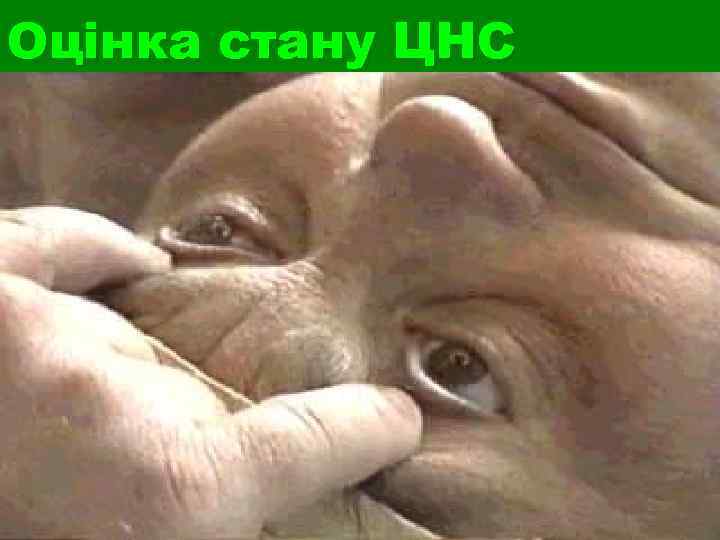 Оцінка стану ЦНС 