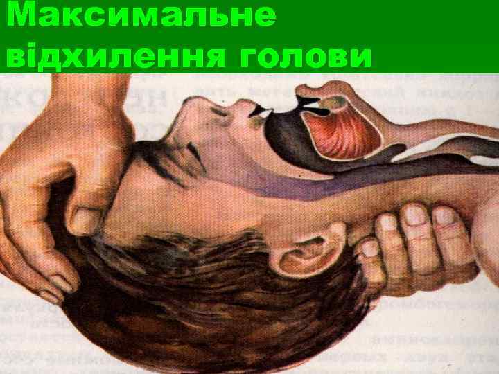 Максимальне відхилення голови 