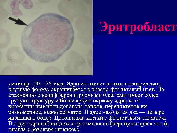 Эритробласт Диаметр - 20— 25 мкм. Ядро его имеет почти геометрически круглую форму, окрашивается