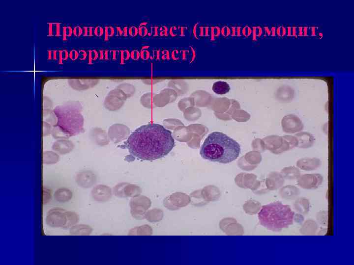 Нормобласты в крови картинки
