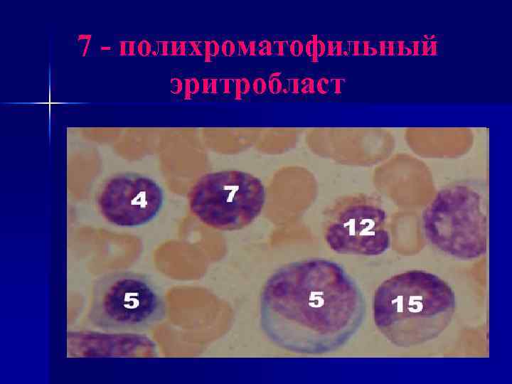 7 - полихроматофильный эритробласт 