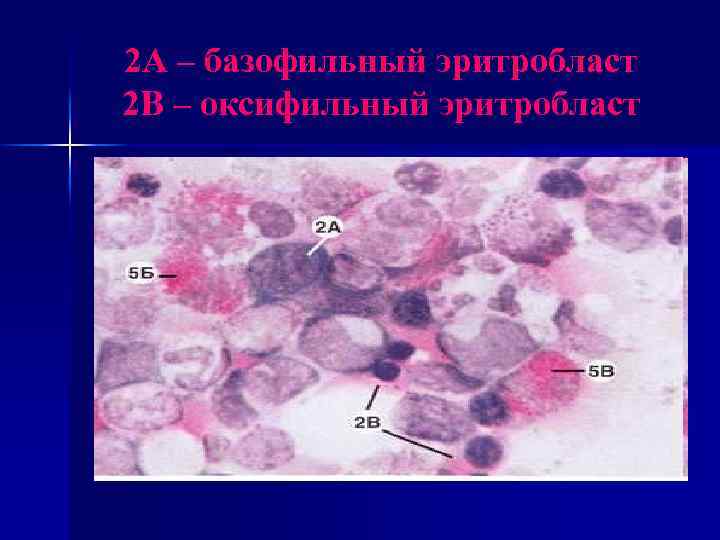 2 А – базофильный эритробласт 2 В – оксифильный эритробласт 