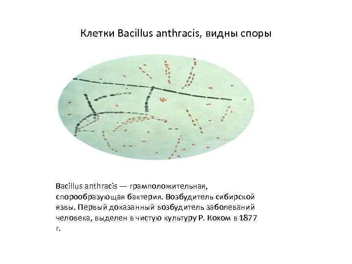 Клетки Bacillus anthracis, видны споры Bacillus anthracis — грамположительная, спорообразующая бактерия. Возбудитель сибирской язвы.