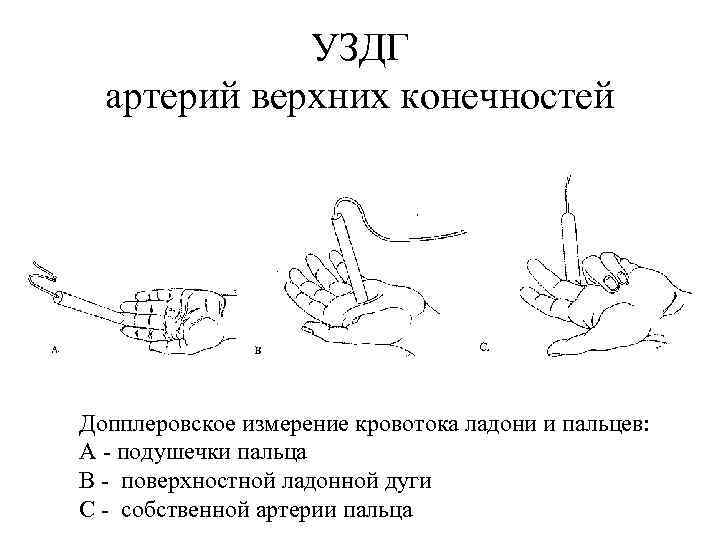 Анатомия артерий верхних конечностей схема для узи