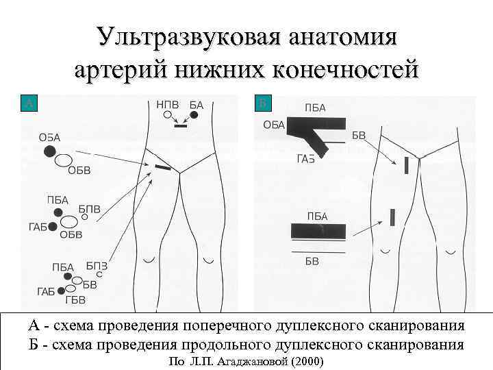 Схема узи вен нижних конечностей