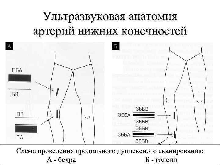 Схема узи вен нижних конечностей