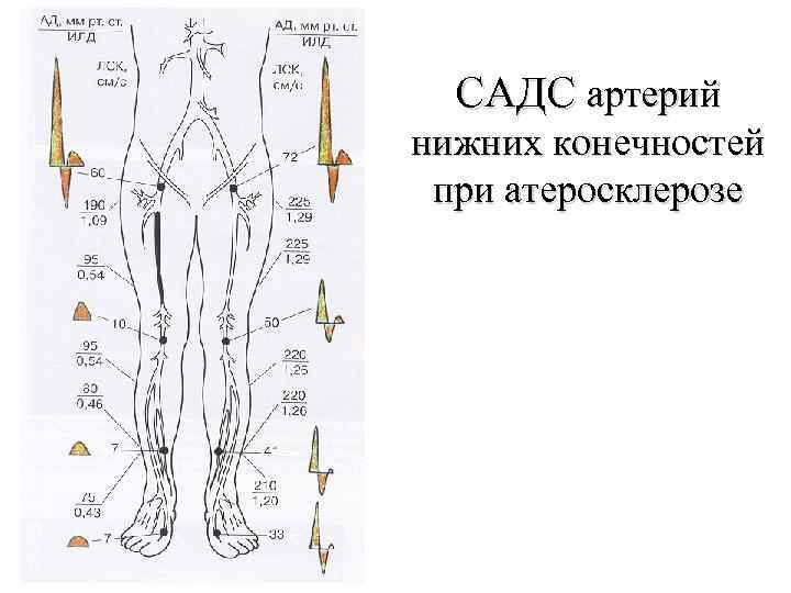 Анатомия артерий верхних конечностей схема для узи