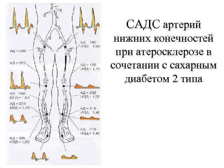 Схема узи нижних конечностей. УЗИ артерий нижних конечностей норма. Сканирование артерий нижних конечностей норма. УЗИ артерий нижних конечностей норма показателей. УЗИ анатомия артерий нижних конечностей.