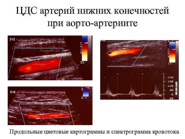 Периферические сосуды