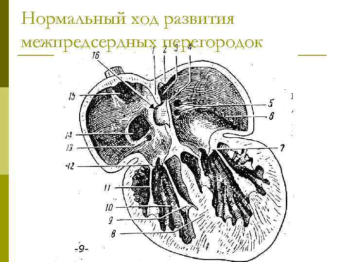 Нормальный ход развития межпредсердных перегородок -9 - 