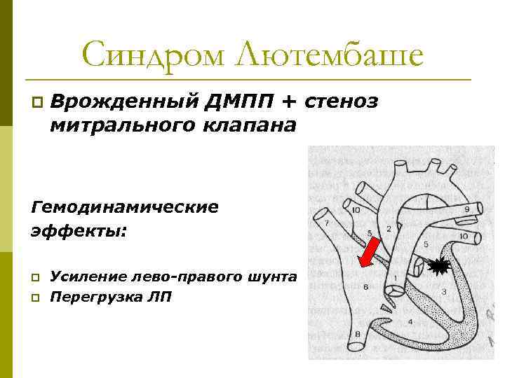 Синдром Лютембаше p Врожденный ДМПП + стеноз митрального клапана Гемодинамические эффекты: p p Усиление