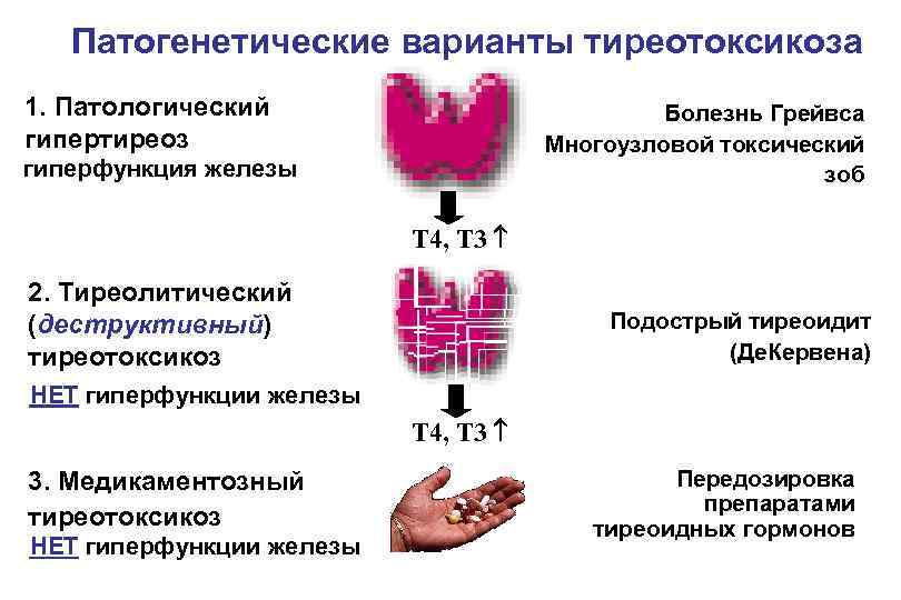 Патогенетические варианты тиреотоксикоза 1. Патологический гипертиреоз Болезнь Грейвса Многоузловой токсический зоб гиперфункция железы Т