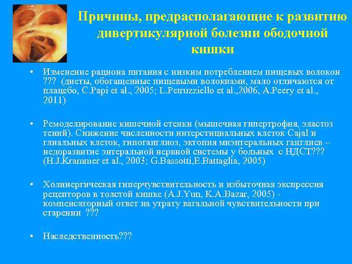 Причины, предрасполагающие к развитию дивертикулярной болезни ободочной кишки • Изменение рациона питания с низким