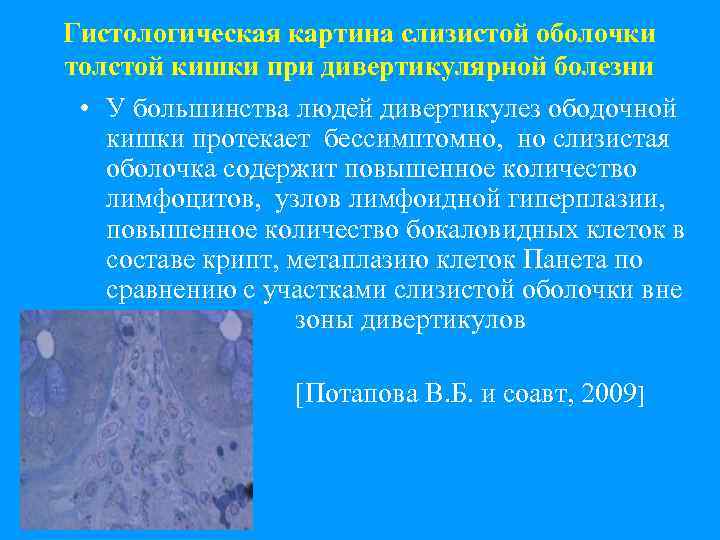 Гистологическая картина слизистой оболочки толстой кишки при дивертикулярной болезни • У большинства людей дивертикулез