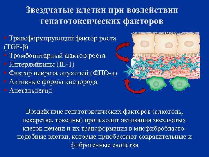 Звездчатые клетки при воздействии гепатотоксических факторов Трансформирующий фактор роста (TGF-β) Тромбоцитарный фактор роста Интерлейкины