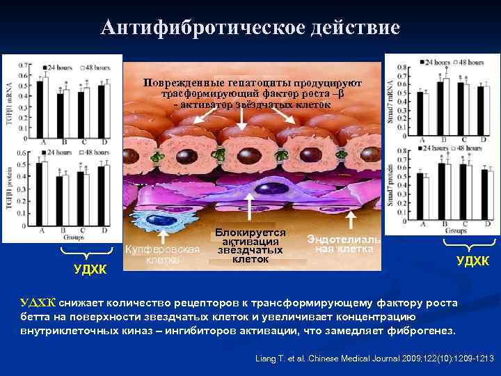 Антифибротическое действие Поврежденные гепатоциты продуцируют трасформирующий фактор роста –β - активатор звёздчатых клеток УДХК