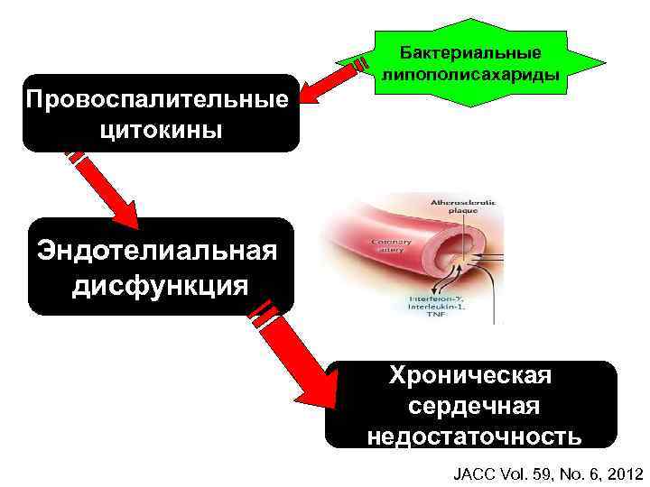 Бактериальные липополисахариды Провоспалительные цитокины Эндотелиальная дисфункция Хроническая сердечная недостаточность JACC Vol. 59, No. 6,