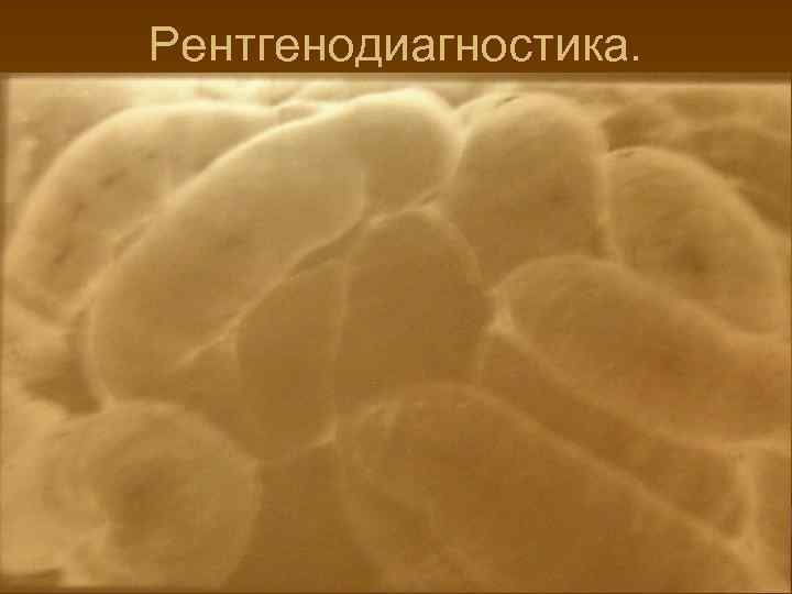 Рентгенодиагностика. 