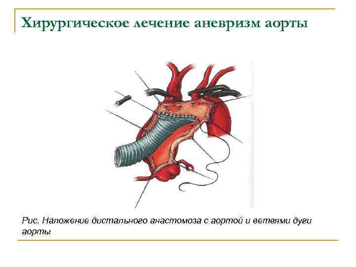 Рассмотрите схему сосудов дуги аорты сделайте к рисунку необходимые обозначения