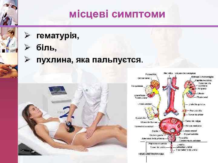 місцеві симптоми Ø гематурія, Ø біль, Ø пухлина, яка пальпуєтся. www. themegallery. com 