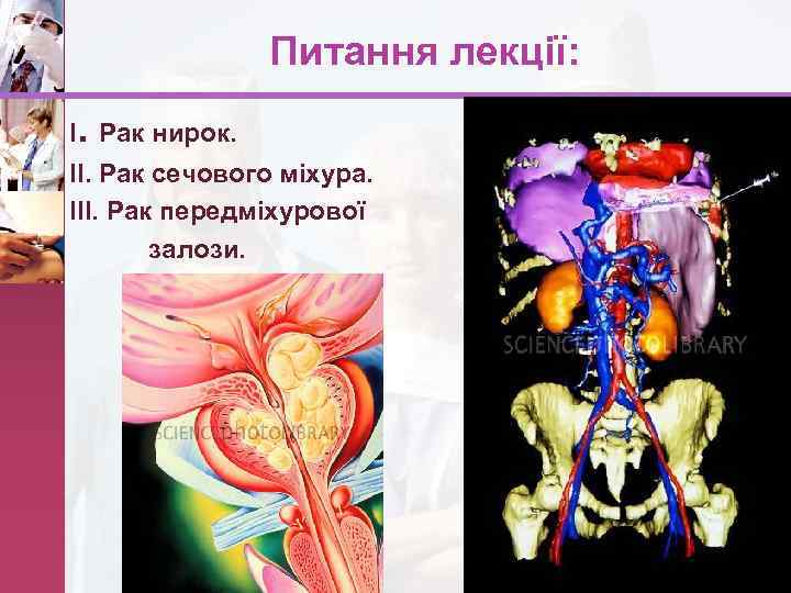 Питання лекції: І. Рак нирок. ІІ. Рак сечового міхура. ІІІ. Рак передміхурової залози. www.