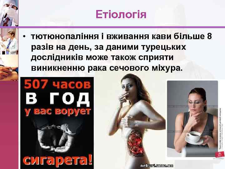 Етіологія • тютюнопаління і вживання кави більше 8 разів на день, за даними турецьких