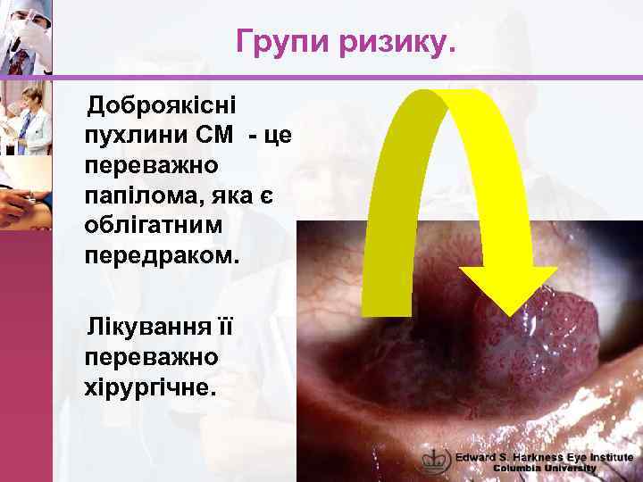 Групи ризику. Доброякісні пухлини СМ - це переважно папілома, яка є облігатним передраком. Лікування