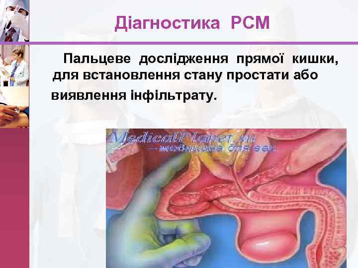 Діагностика РСМ Пальцеве дослідження прямої кишки, для встановлення стану простати або виявлення інфільтрату. www.
